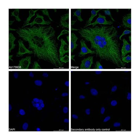 aladdin 阿拉丁 Ab179938 alpha Tubulin Mouse mAb mAb (AB01/5A12); Mouse anti Human alpha tubulin Antibody; WB, Flow, ICC/IF, ELISA; Unconjugated