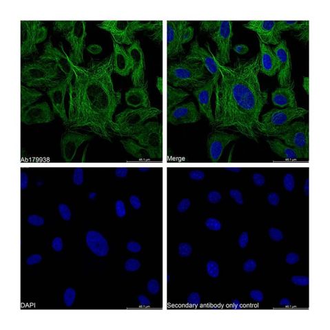aladdin 阿拉丁 Ab179938 alpha Tubulin Mouse mAb mAb (AB01/5A12); Mouse anti Human alpha tubulin Antibody; WB, Flow, ICC/IF, ELISA; Unconjugated