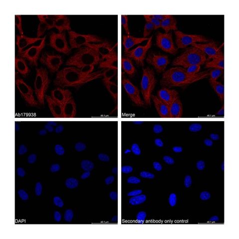 aladdin 阿拉丁 Ab179938 alpha Tubulin Mouse mAb mAb (AB01/5A12); Mouse anti Human alpha tubulin Antibody; WB, Flow, ICC/IF, ELISA; Unconjugated