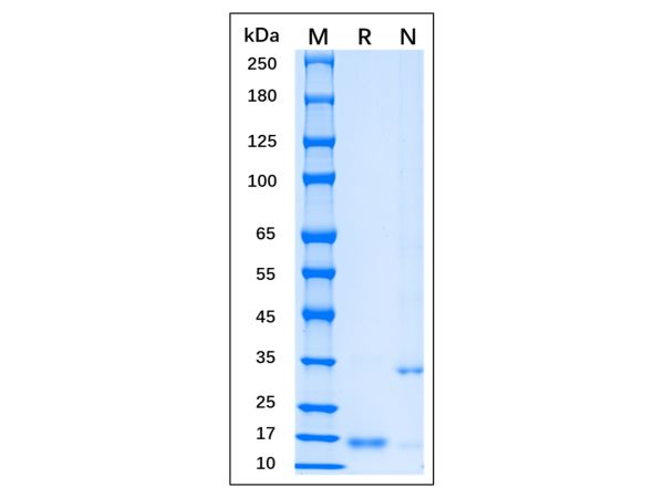 aladdin 阿拉丁 rp155843 Recombinant MPXV A35R Protein Carrier free , >95% (SDS-PAGE), E. coli, N-His tag, 58-181 aa