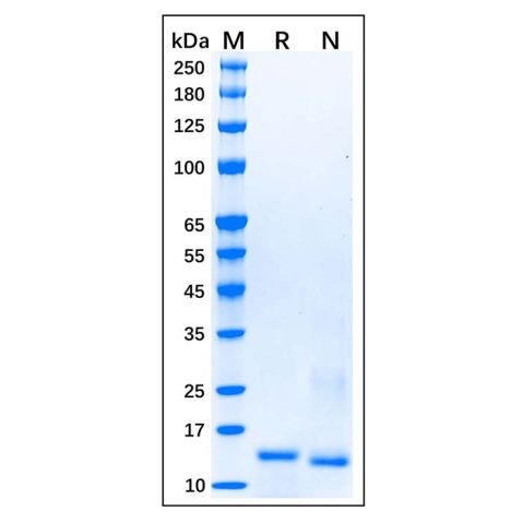 aladdin 阿拉丁 rp156654 Recombinant Human Smad3 Protein Carrier Free, >95% (SDS-PAGE), E.coli, His Tag, 1-100 aa
