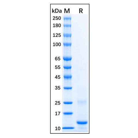 aladdin 阿拉丁 rp156664 Recombinant Human CTGF Protein Carrier Free, >90% (SDS-PAGE), E.coli, His Tag, 253-349 aa