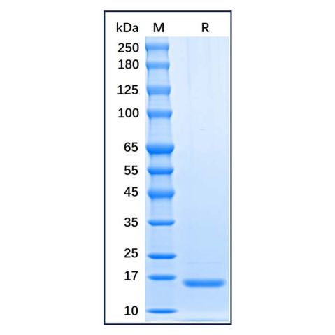 aladdin 阿拉丁 rp169653 Recombinant Human TSLP Protein Carrier Free, >95%(SDS-PAGE), Active, E.coli, N-His tag, 29-159 aa