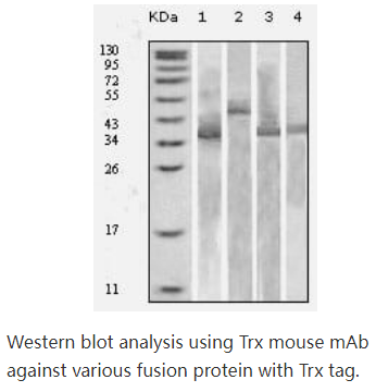 Thioredoxin (TRX)