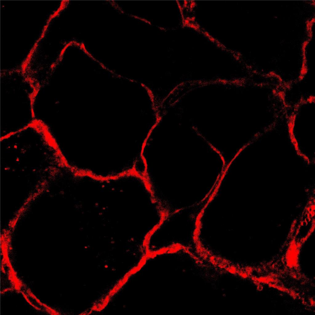 AIE细胞膜红色探针/固定细胞染色/活细胞染色/聚集诱导发光特性/多次成像探针