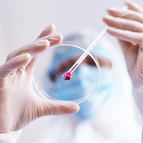 SLITRK6蛋白-ACROBiosystems百普赛斯