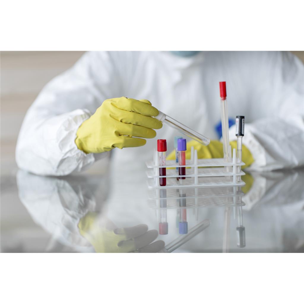 高血压细胞模型