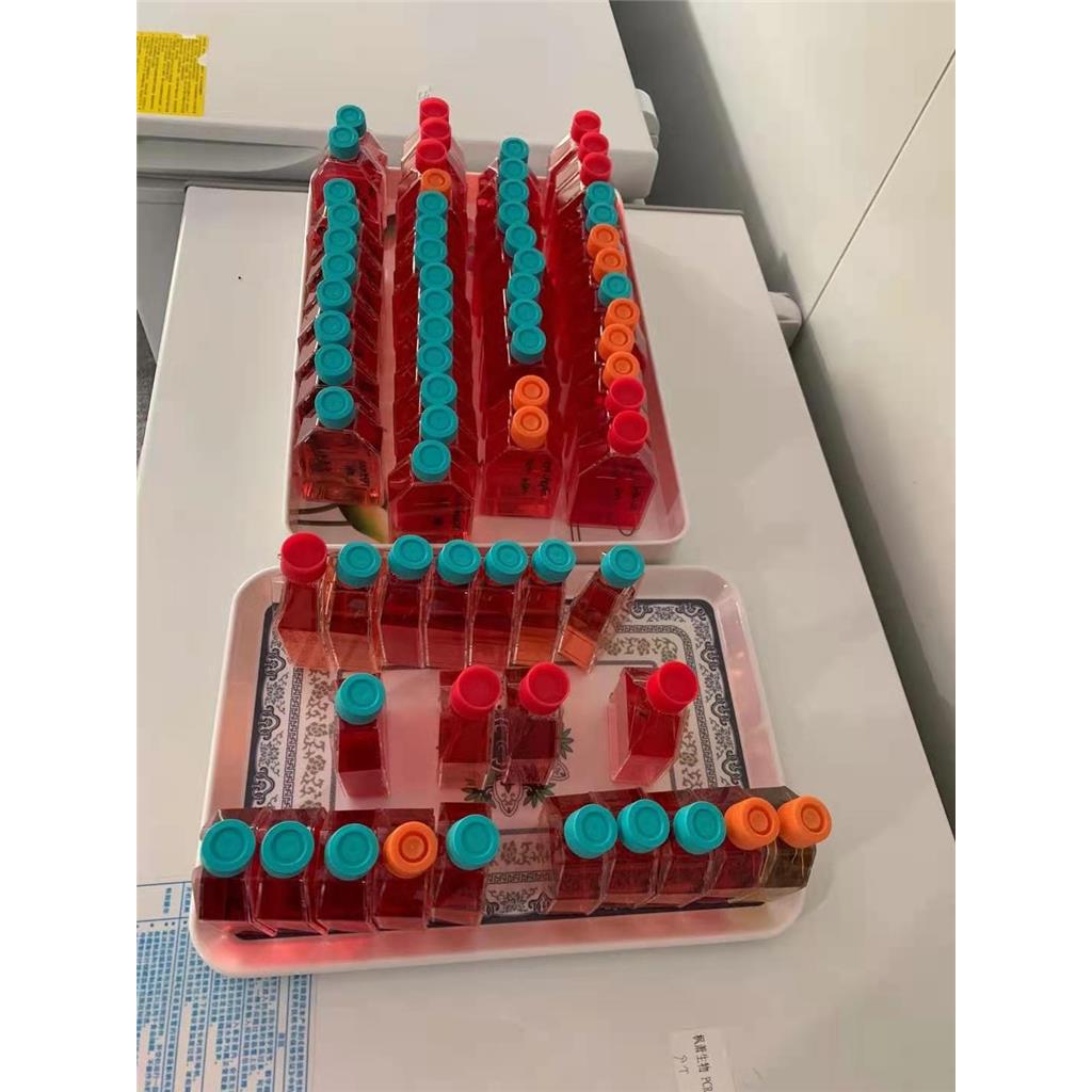 人卵巢癌细胞A2780/GFP