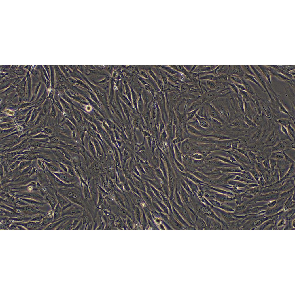 人肾透明细胞癌皮肤转移细胞CAKI1