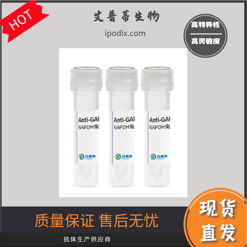 KCNB1抗体；KCNB1 antibody 艾普蒂生物              