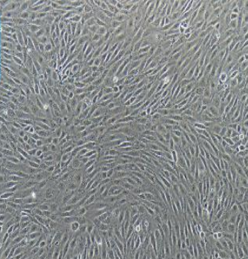 人骨肉瘤细胞U-2OS