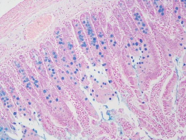 MED13抗体；MED13 antibody  艾普蒂生物              