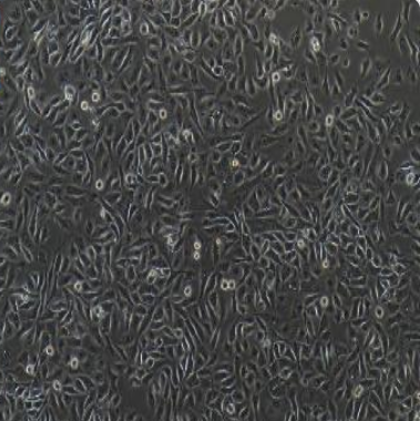 人结肠癌氟尿嘧啶耐药株HCT/Fu