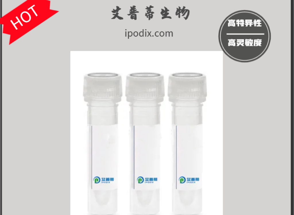 DNTT蛋白抗体；DNTT antibody 艾普蒂生物       
