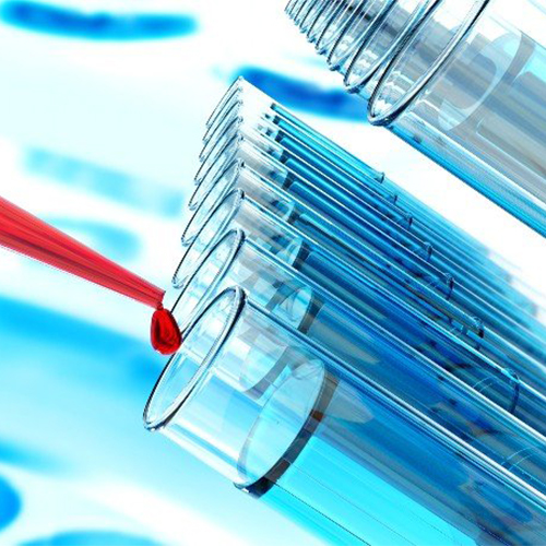 TSLP ELISA试剂盒-ACROBiosystems百普赛斯