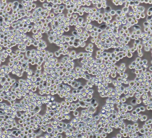 人宫颈上皮细胞HCerEpiCs-SV40T