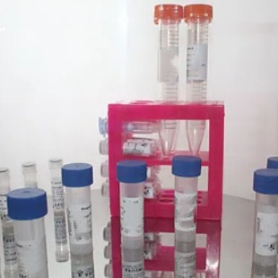 SIAH1抗体；SIAH1 antibody 艾普蒂生物        