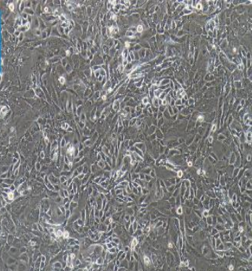 人主动脉血管平滑肌细胞T/G HA-VSMC