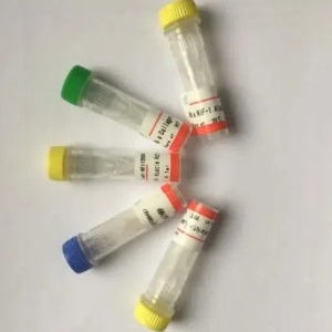 LYPLA2抗体；LYPLA2  antibody 艾普蒂生物        