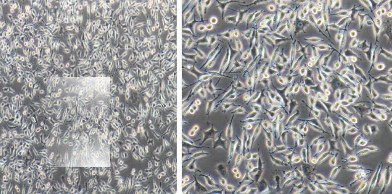 人神经母细胞瘤细胞SKNBE(2)C