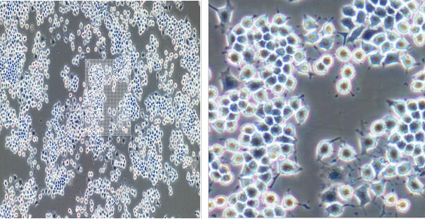 大鼠正常胃黏膜上皮细胞RGM1