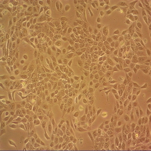 NOMO-1人白血病细胞