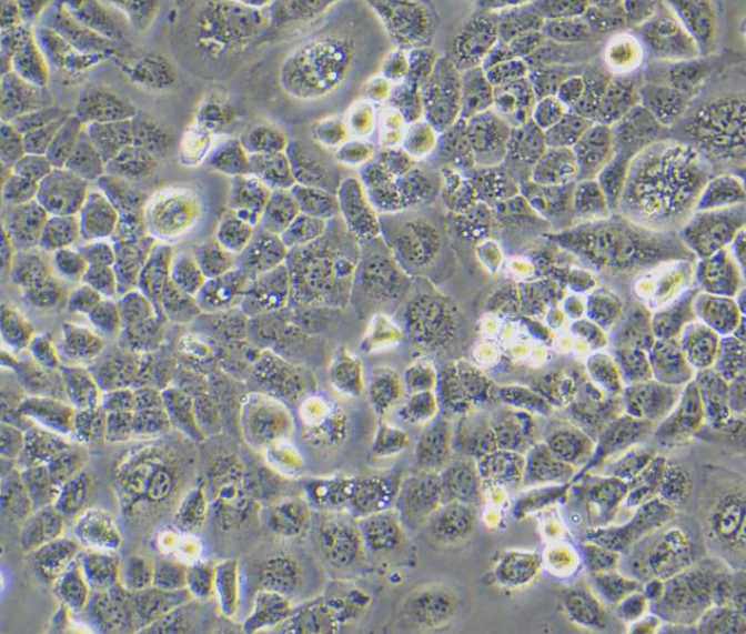 人类星形胶质细胞瘤细胞U251MG，ATCC来源