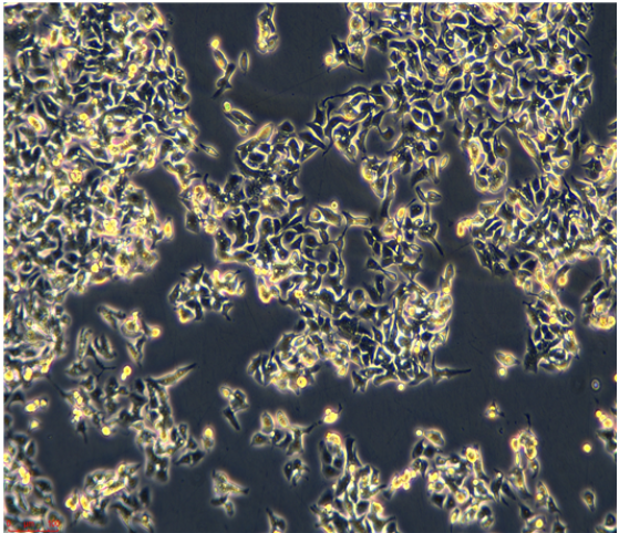 人喉癌细胞TU212，ATCC来源