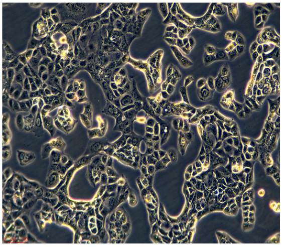 人胃癌细胞NUGC4，ATCC来源