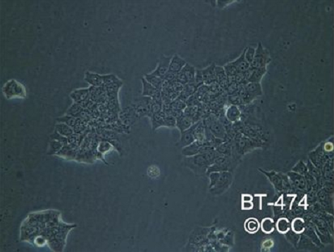 人乳腺癌细胞HCC1428，ATCC来源