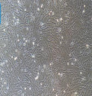 人乳腺癌细胞CAL148，ATCC来源