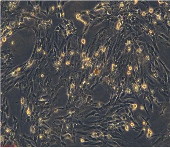 人淋巴母细胞瘤(EBV转化)NCIBL2009，ATCC来源