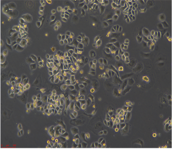 人肺乳头状腺癌细胞NCIH820，ATCC来源