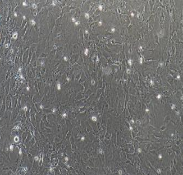 人小细胞肺癌NCIH1048，ATCC来源