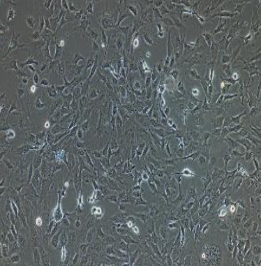 人乳腺原发性导管癌HCC202，ATCC来源