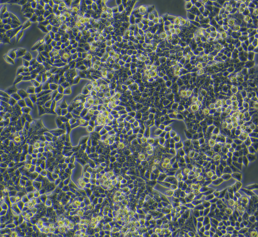 人肾小球系膜细胞HMC