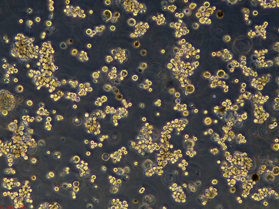 PC-3M人前列腺癌细胞