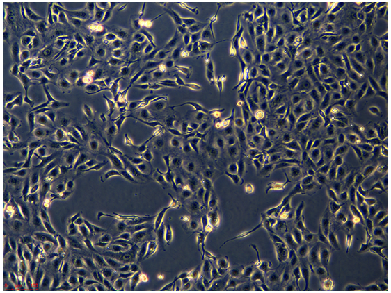人胃癌细胞SGC-7901