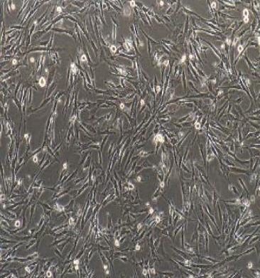 4T1.2小鼠乳腺癌细胞骨转移模型