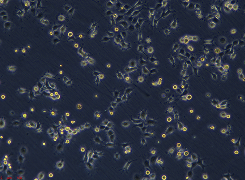 人前列腺癌细胞C42B，ATCC来源