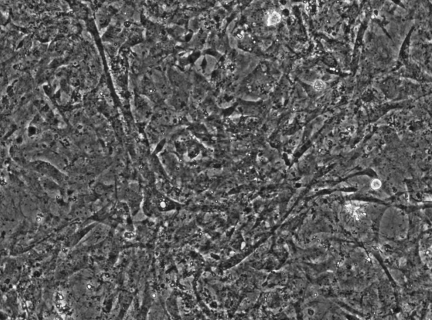 人胆管癌细胞TFK1，ATCC细胞