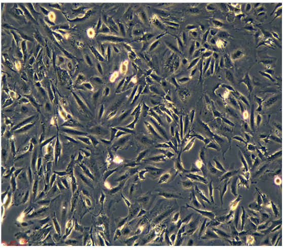 人气管平滑肌细胞HTSMC，ATCC细胞