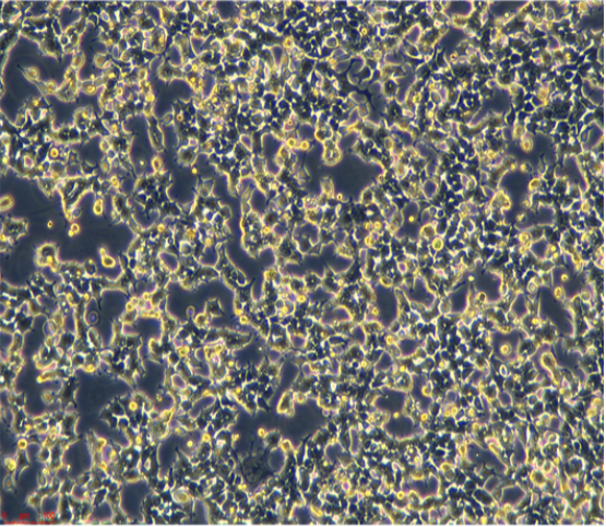 人肺良性肿瘤细胞UMC11，ATCC细胞