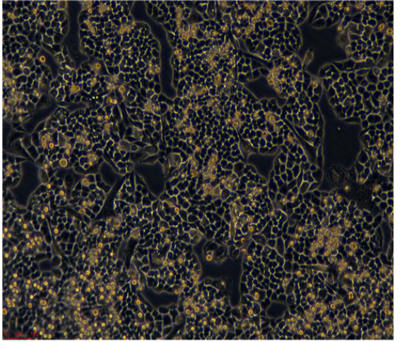 大鼠乳腺癌细胞MRMT1，ATCC细胞