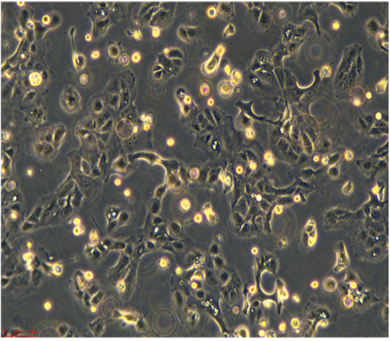 人瓣膜间质细胞PVIC-HTERT，ATCC细胞