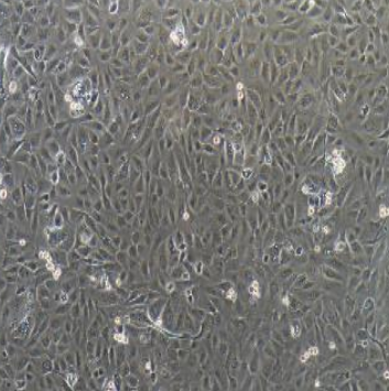 人胚肾细胞293T/17，ATCC细胞