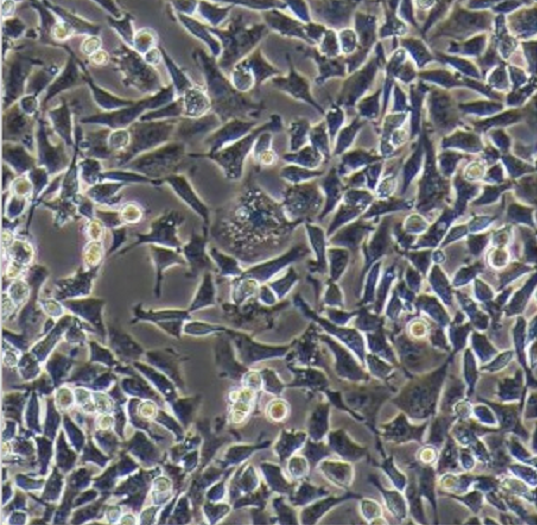 人成纤维细胞GM01176，ATCC细胞