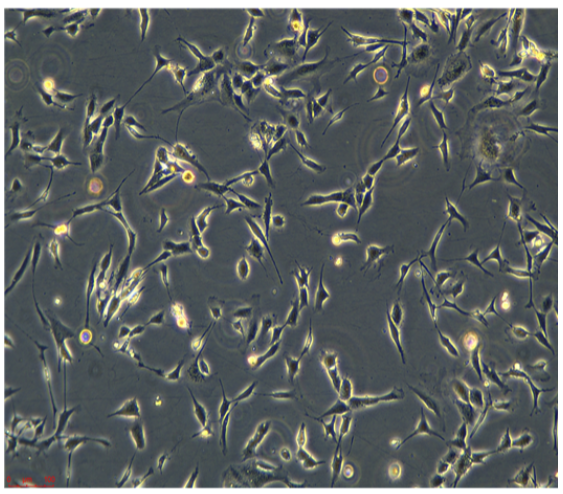 人B淋巴细胞GM50152，ATCC细胞