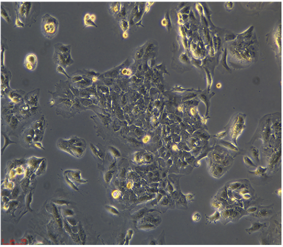 人子宫膜腺癌细胞HEC1B/LUC(带荧光素酶)
