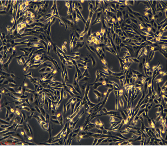 人胃癌细胞黄色荧光标记HGC27YFP/LUC(带荧光素酶)